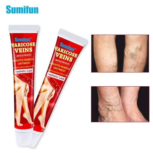 Pomada Crema Para Las Varices