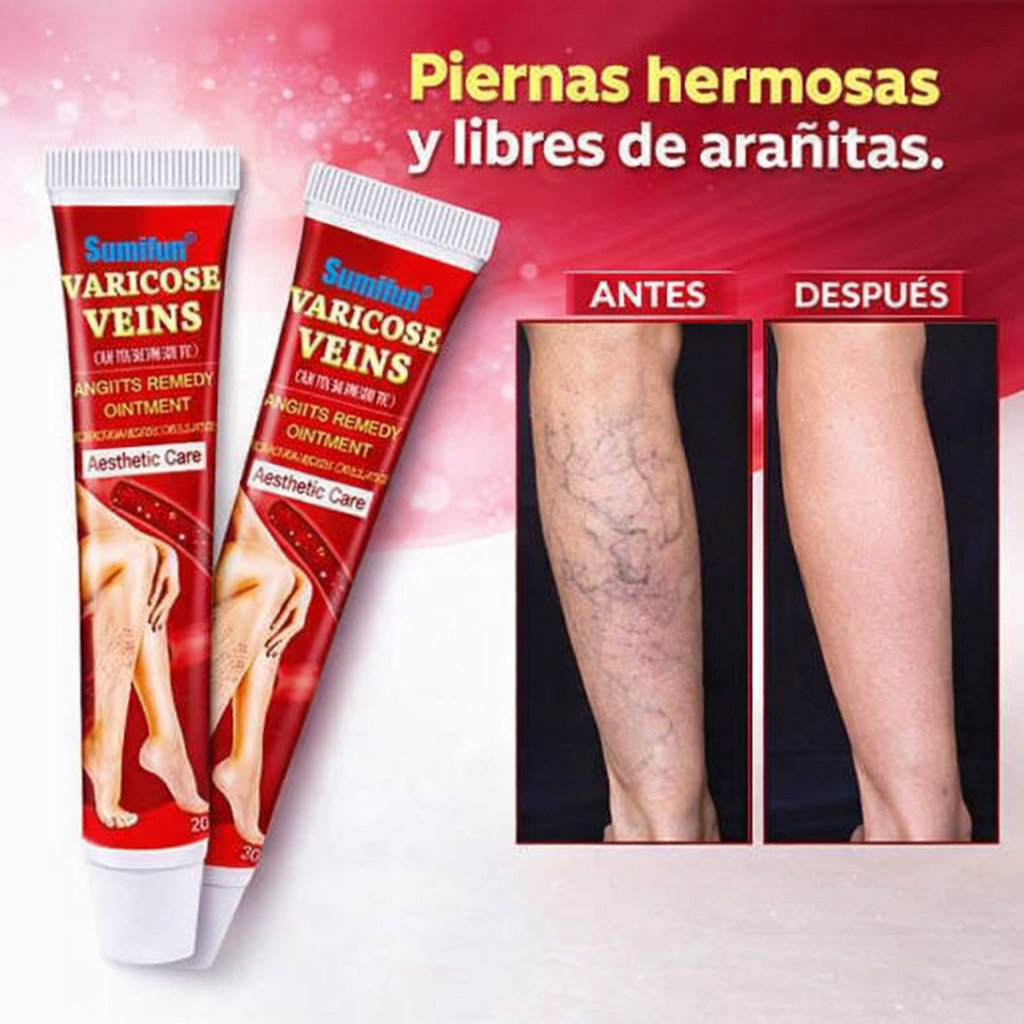 Pomada Crema Para Las Varices